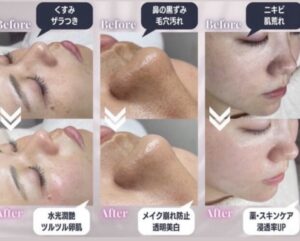 wax施術後の前後を比較した画像